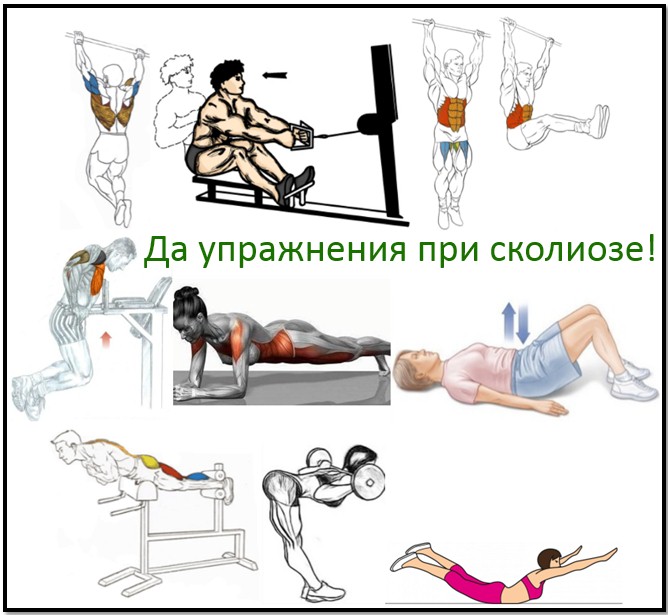 Смотреть упражнения для грыжа позвоночника Смотреть упражнения для грыжа позвоночника
