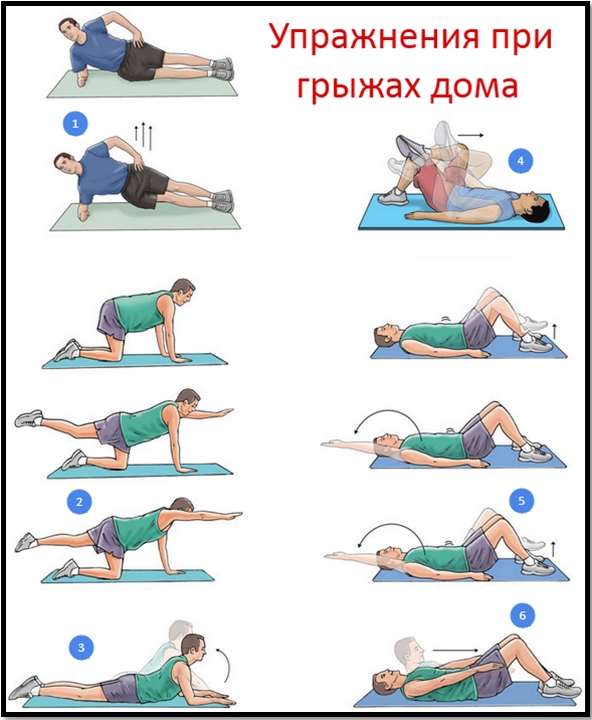 Лечение межпозвоночной грыжи в домашних условиях упражнения Лечение межпозвоночной грыжи в домашних условиях упражнения