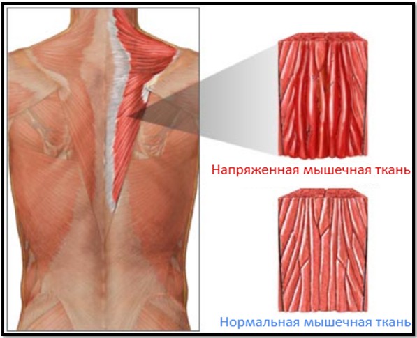 doms-delayed-onset-muscle-soreness-what-does-it-really-indicate